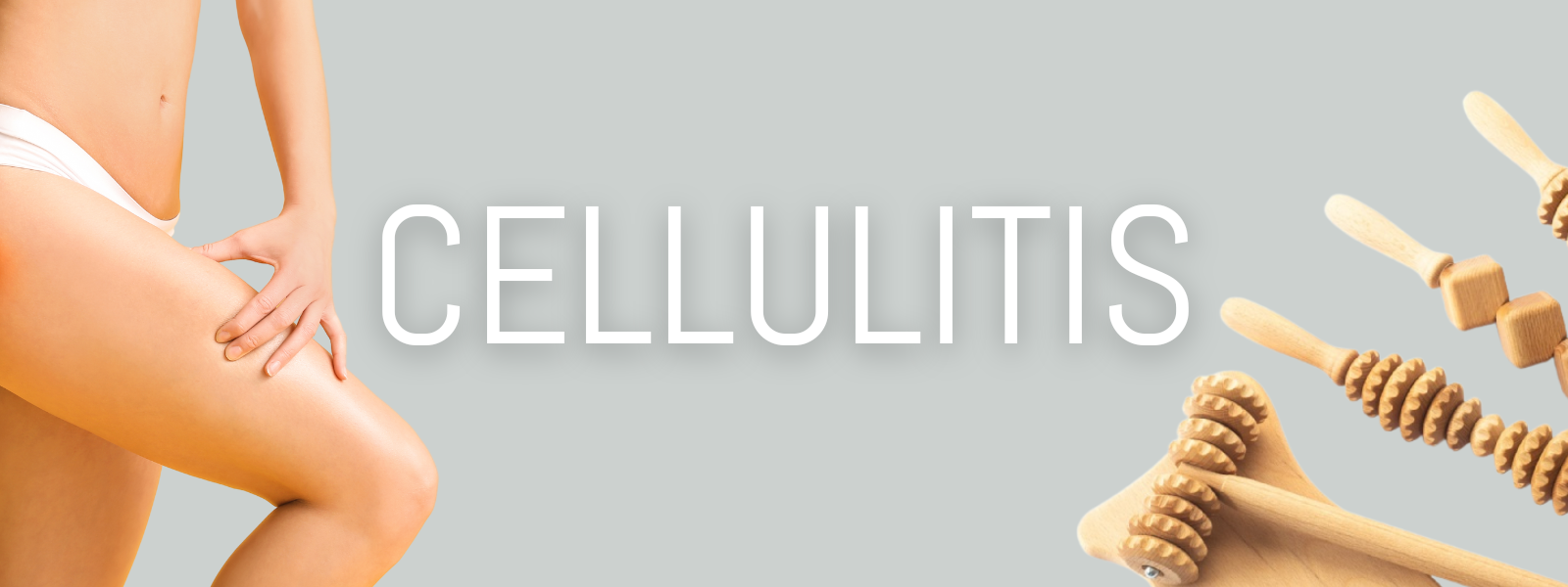 Cellulitis